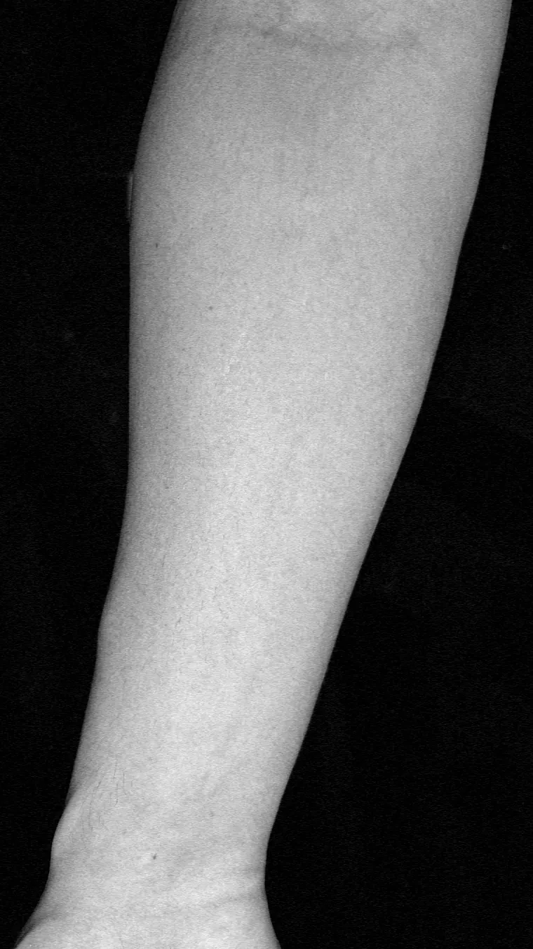 Fase 1: a foto do antebraço, antes do desenho